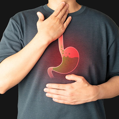 Esophageal conditions