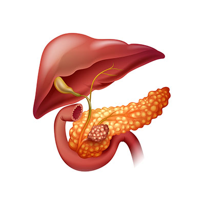 Pancreatic Disorders